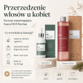 łysienie androgenowe kobiet kaaral k05.png